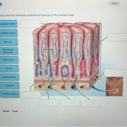 Label anatomical features correctly following cerebellum structures nearby solved superior medulla transcribed problem text been show has colliculus