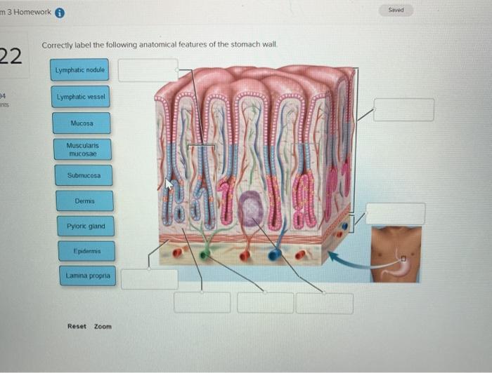 Label anatomical features correctly following cerebellum structures nearby solved superior medulla transcribed problem text been show has colliculus