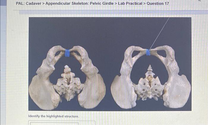 Pal cadaver appendicular skeleton pectoral girdle lab practical question 1